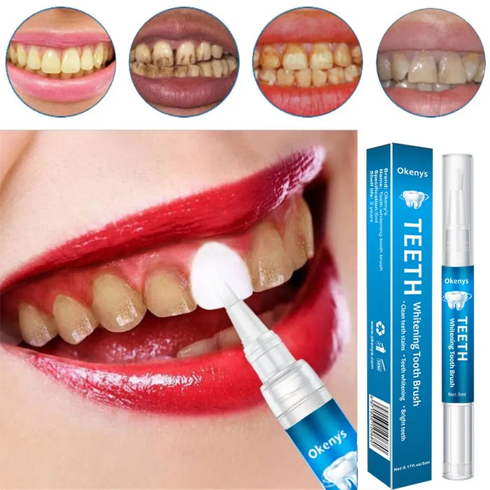 Instant Smile Teeth Whitening Pen